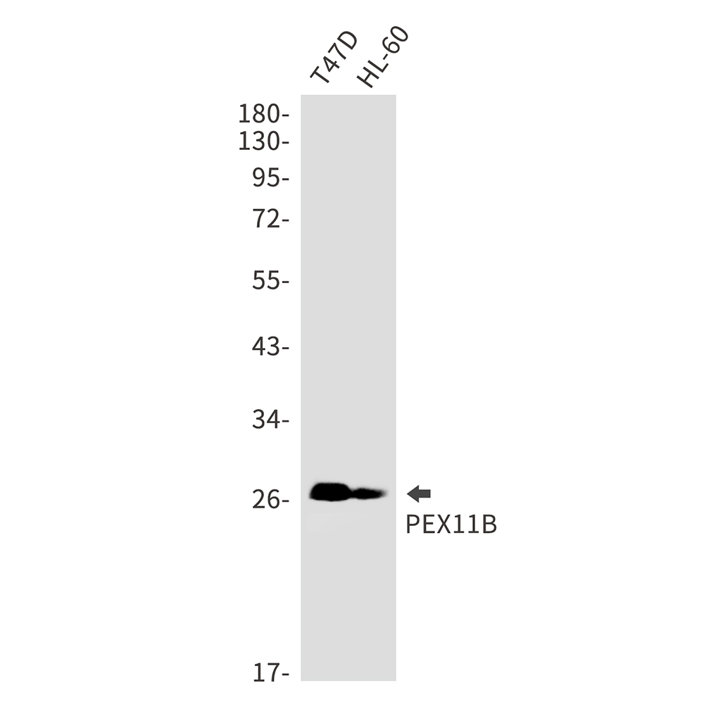 PEX11B Rabbit mAb