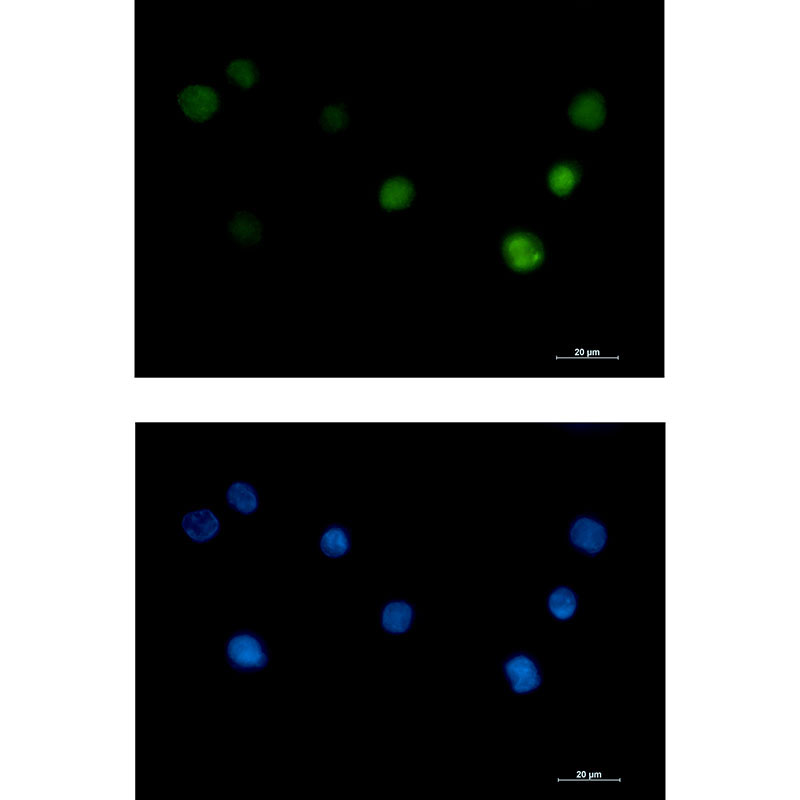 PHAPI2 Rabbit mAb