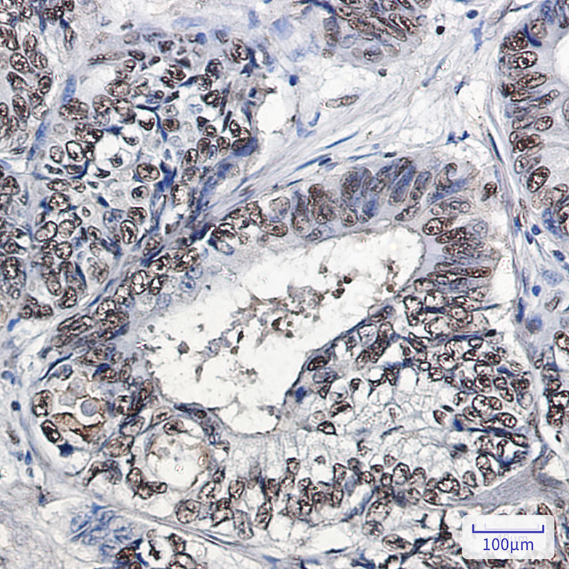 PHAPI2 Rabbit mAb