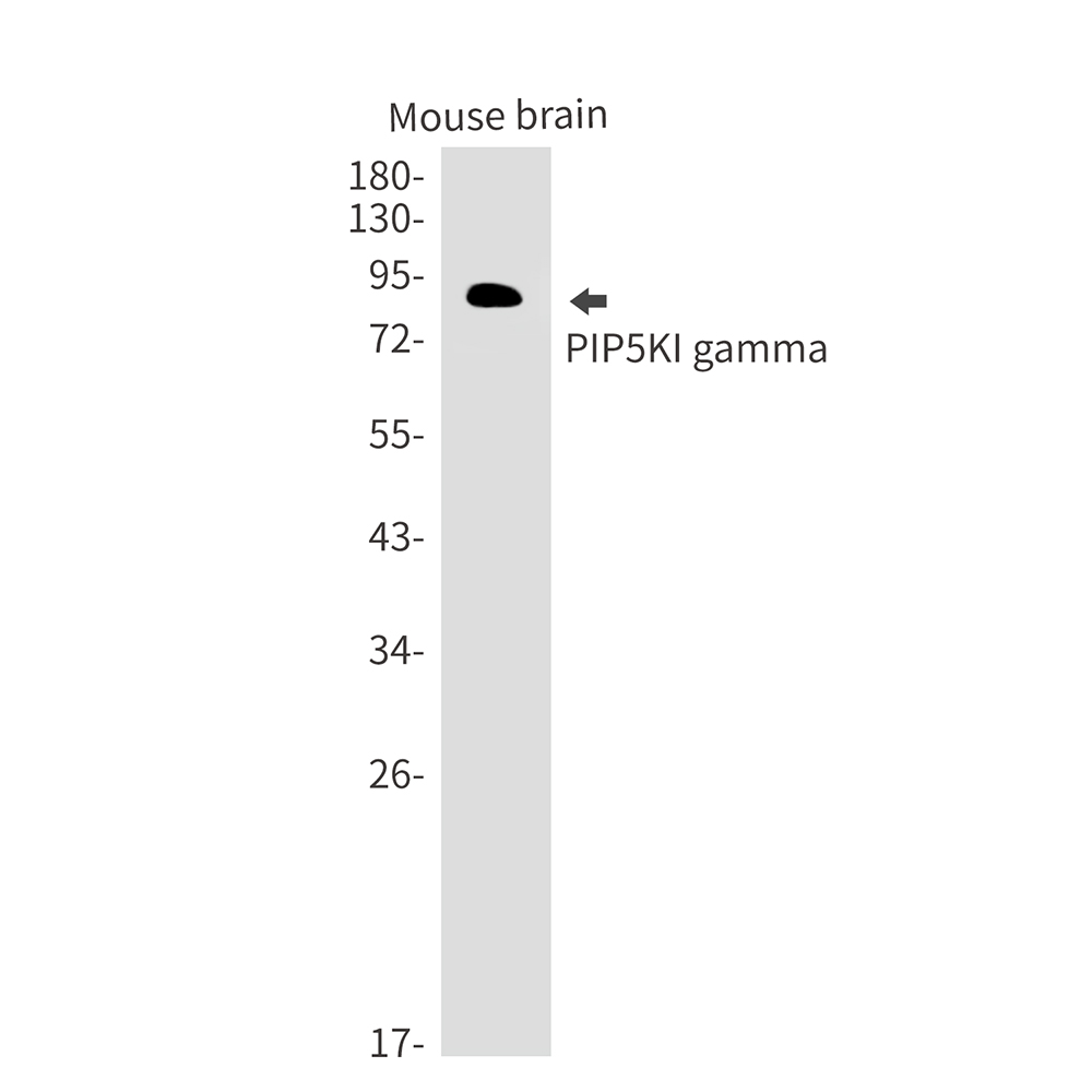 PIP5K1C Rabbit mAb