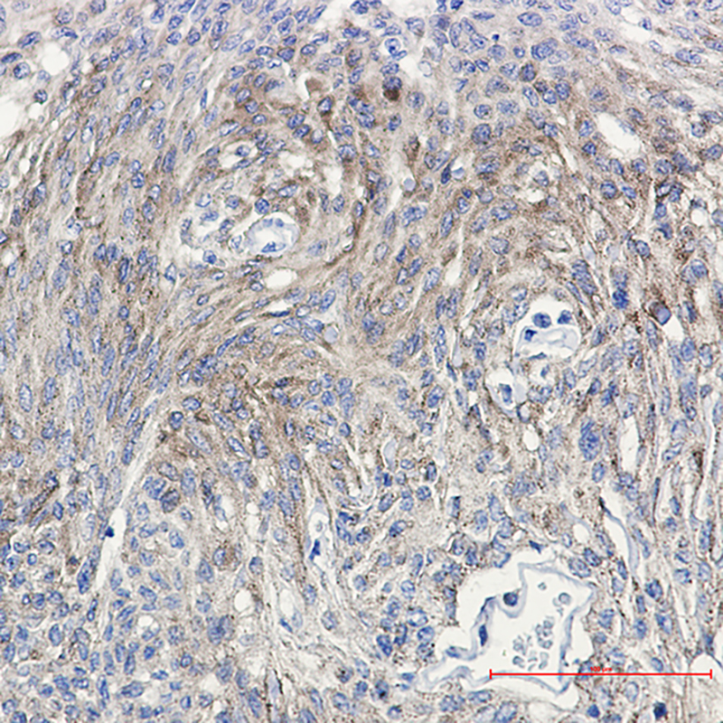 Phospho-PKC gamma (Thr514) Rabbit mAb