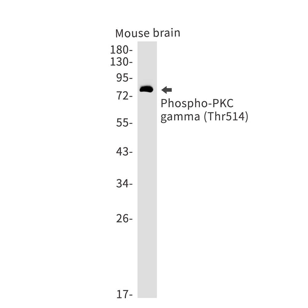 Phospho-PKC gamma (Thr514) Rabbit mAb