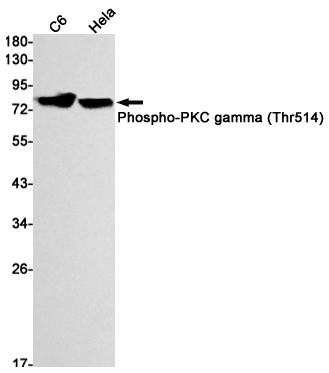 Phospho-PKC gamma (Thr514) Rabbit mAb