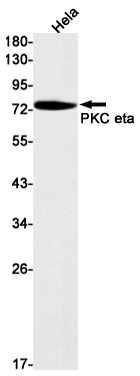 PKC eta Rabbit mAb