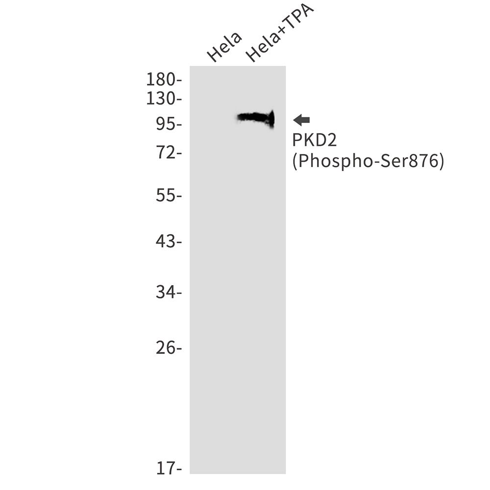 Phospho-PRKD2 (Ser876) Rabbit mAb