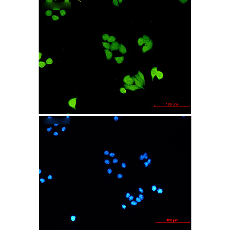 PLK1 Rabbit mAb
