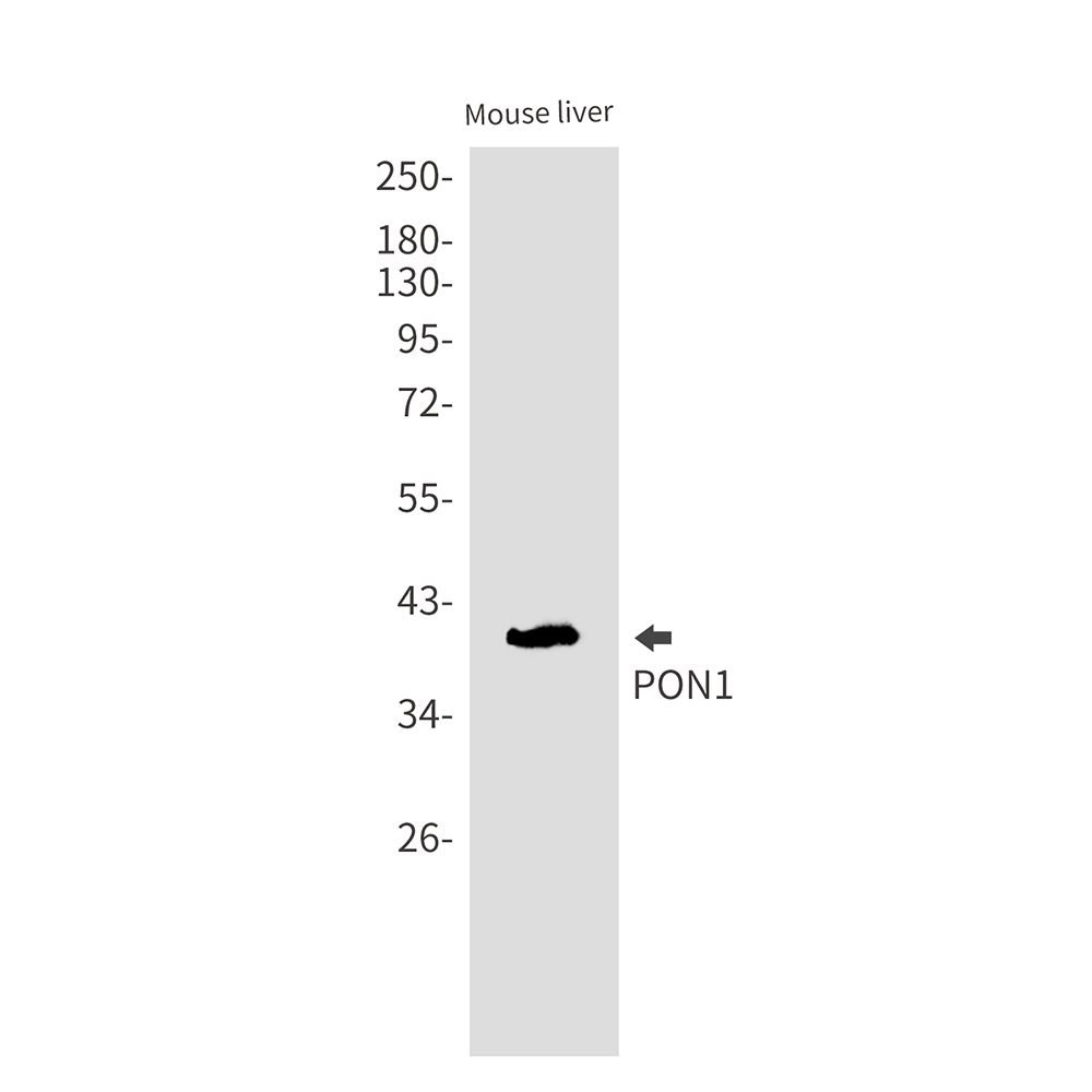 PON1 Rabbit mAb