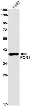PON1 Rabbit mAb