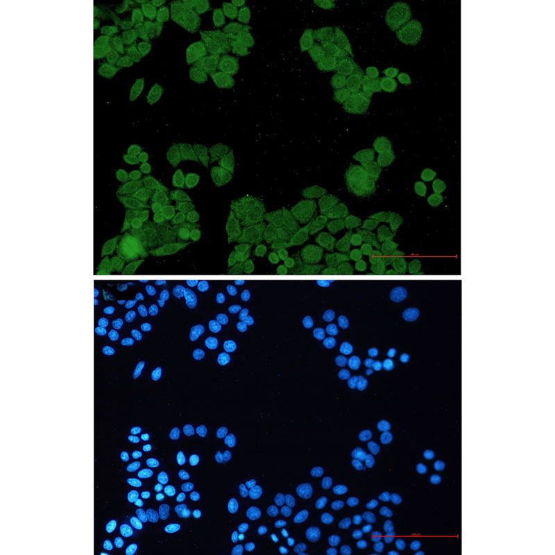 PP2A alpha/beta Rabbit mAb
