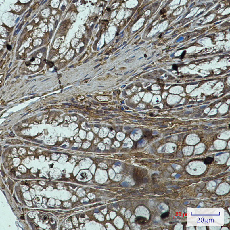 PP1C alpha/beta Rabbit mAb