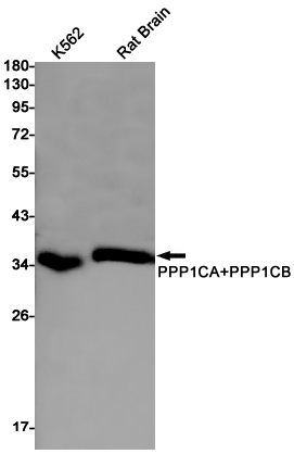 PP1C alpha/beta Rabbit mAb