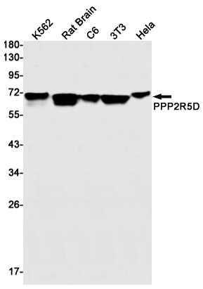 PPP2R5D Rabbit mAb