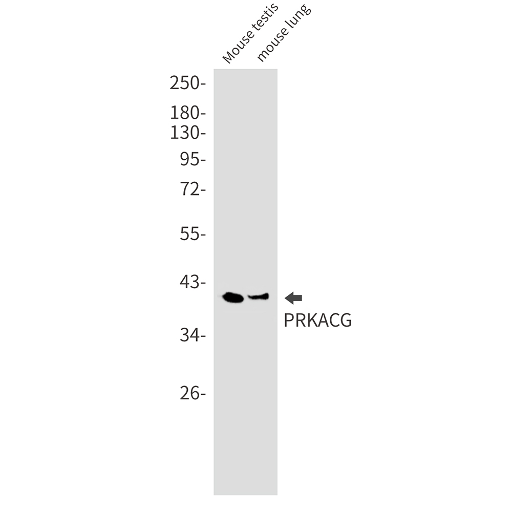 PKA C gamma Rabbit mAb