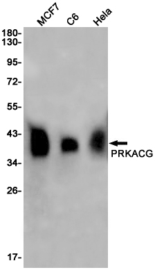 PKA C gamma Rabbit mAb