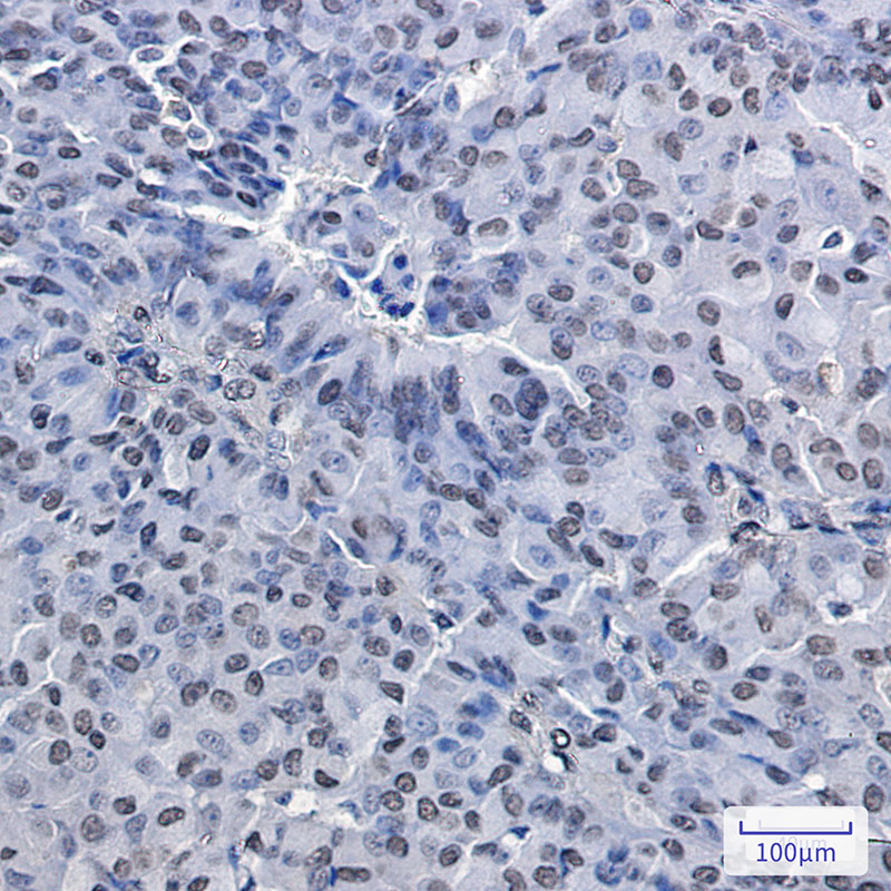 PRMT1 Rabbit mAb
