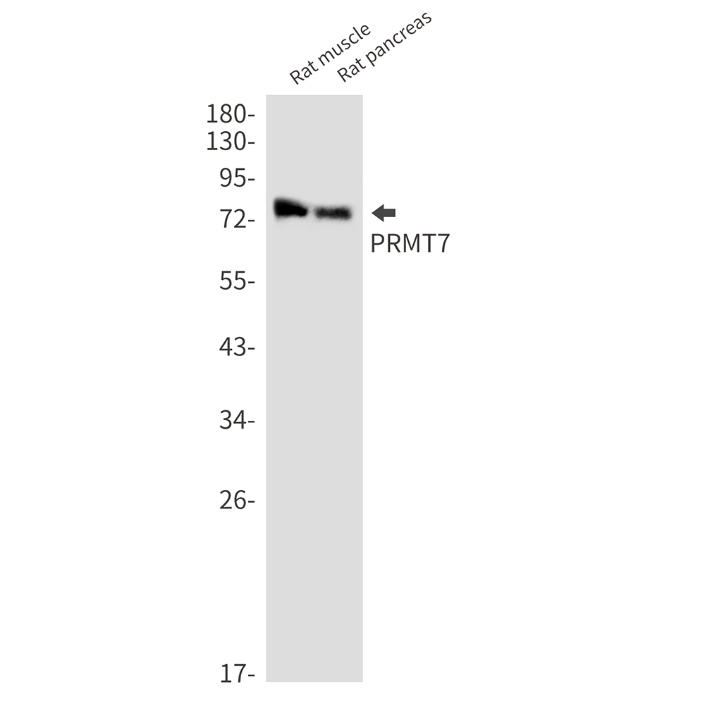PRMT7 Rabbit mAb
