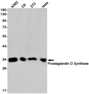 Prostaglandin D Synthase Rabbit mAb