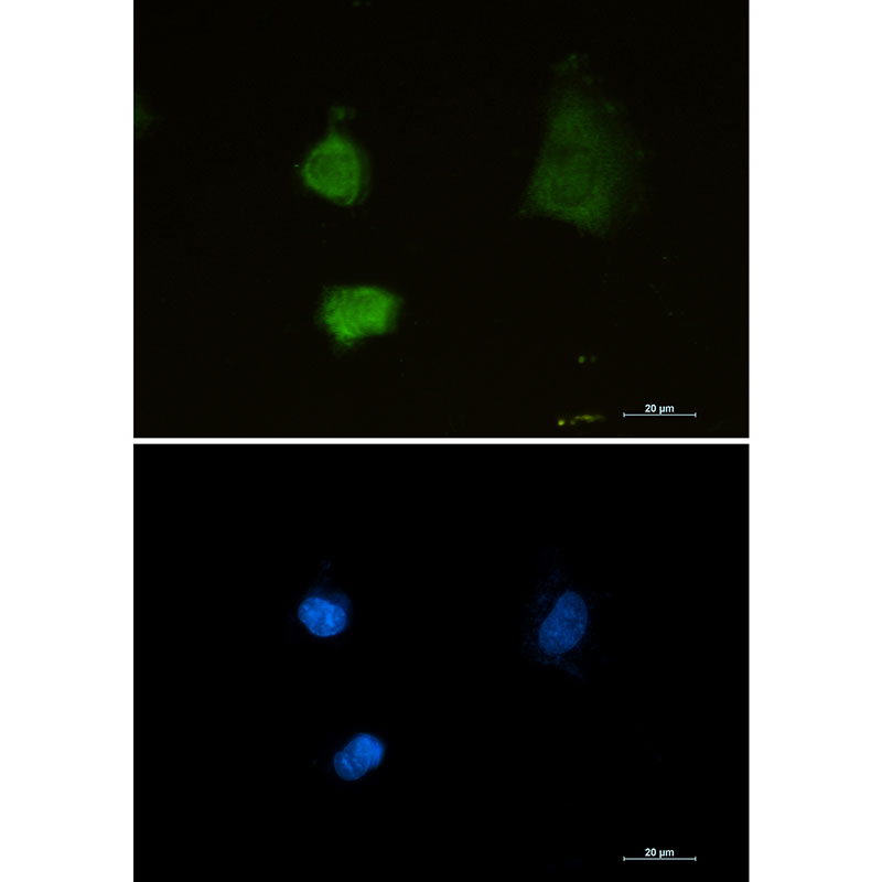 Proteasome alpha 2 Rabbit mAb