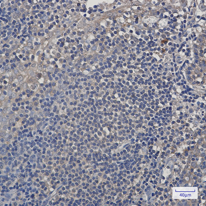 PSMA4 Rabbit mAb