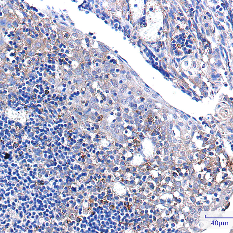 PUM1 Rabbit mAb