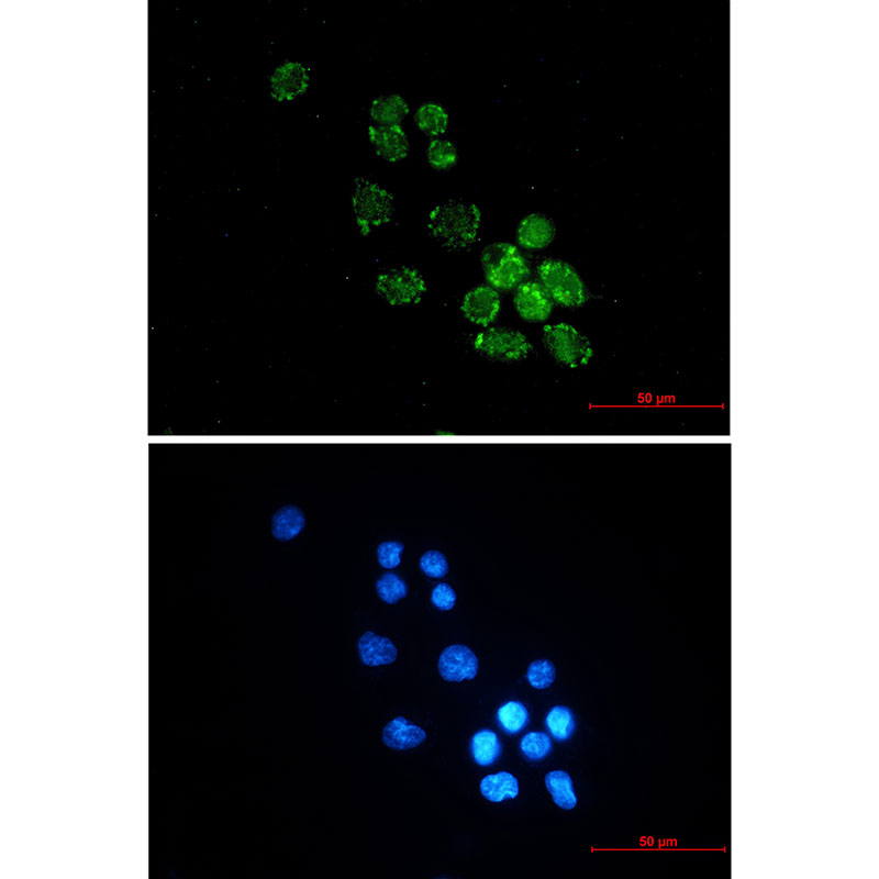PUS1 Rabbit mAb