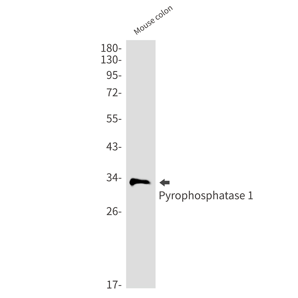 Pyrophosphatase 1 Rabbit mAb