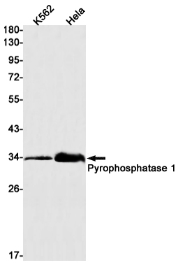 Pyrophosphatase 1 Rabbit mAb