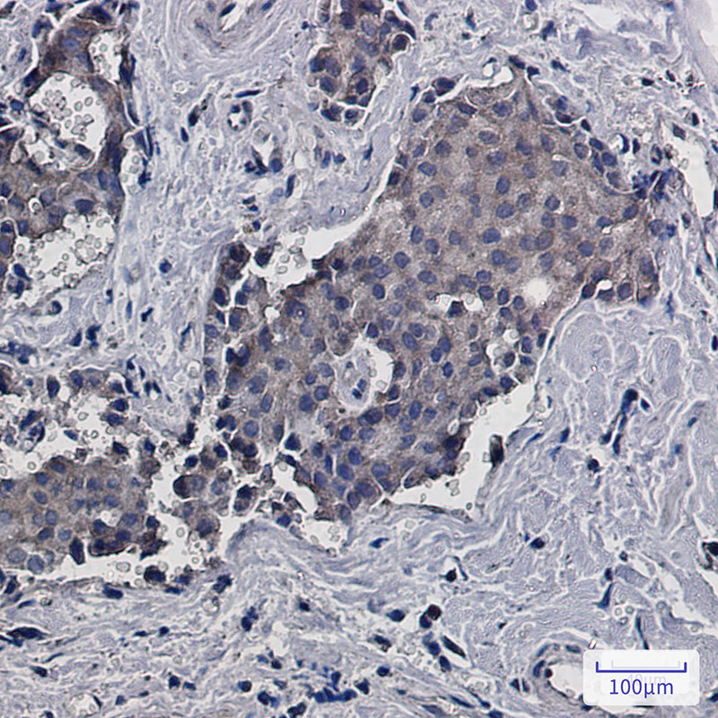 RACK1 Rabbit mAb
