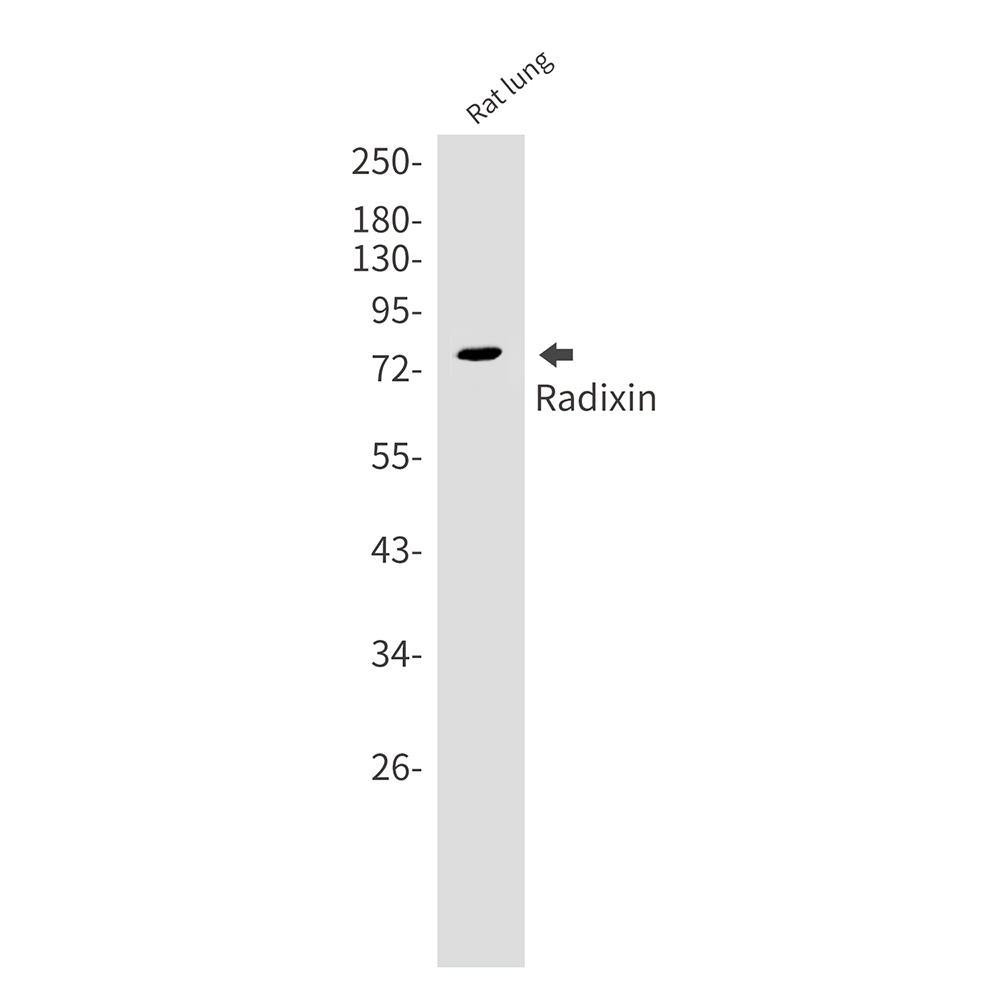 Radixin Rabbit mAb