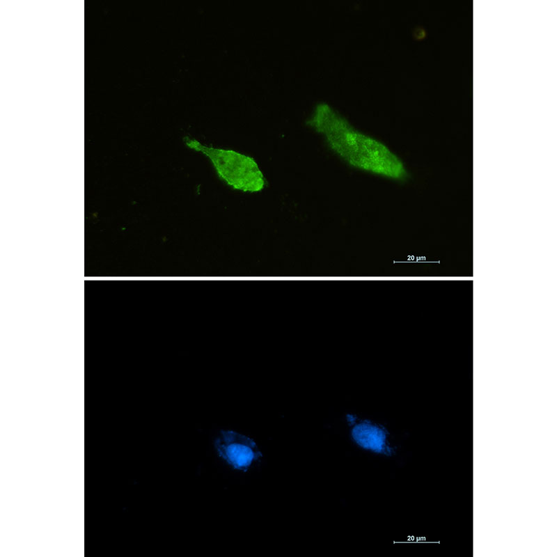 Ran Rabbit mAb