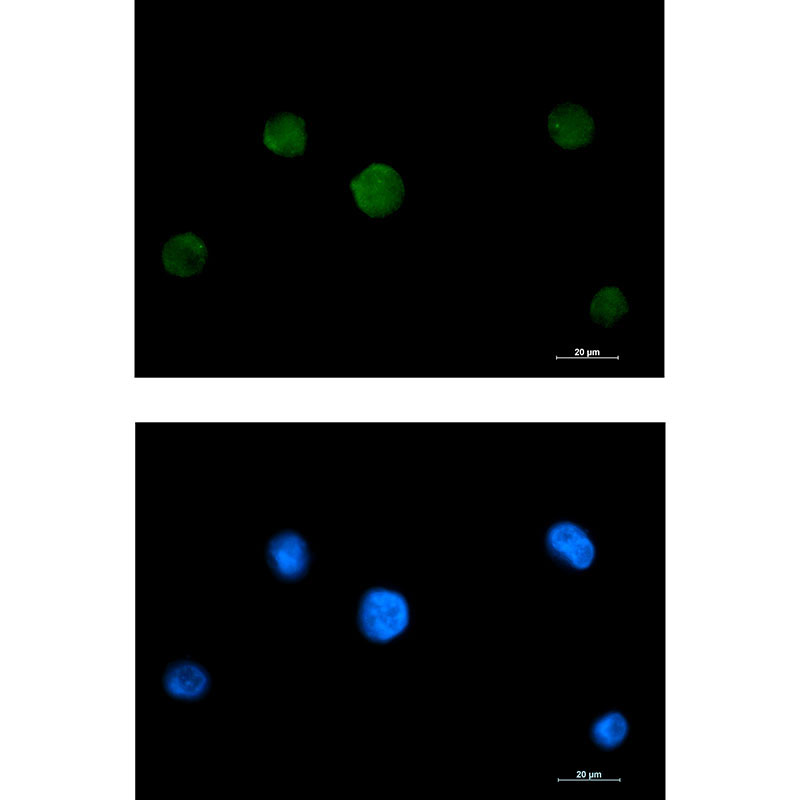 RAVER2 Rabbit mAb