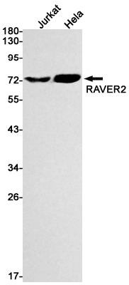 RAVER2 Rabbit mAb