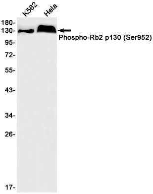 Phospho-Rb2 p130 (Ser952) Rabbit mAb