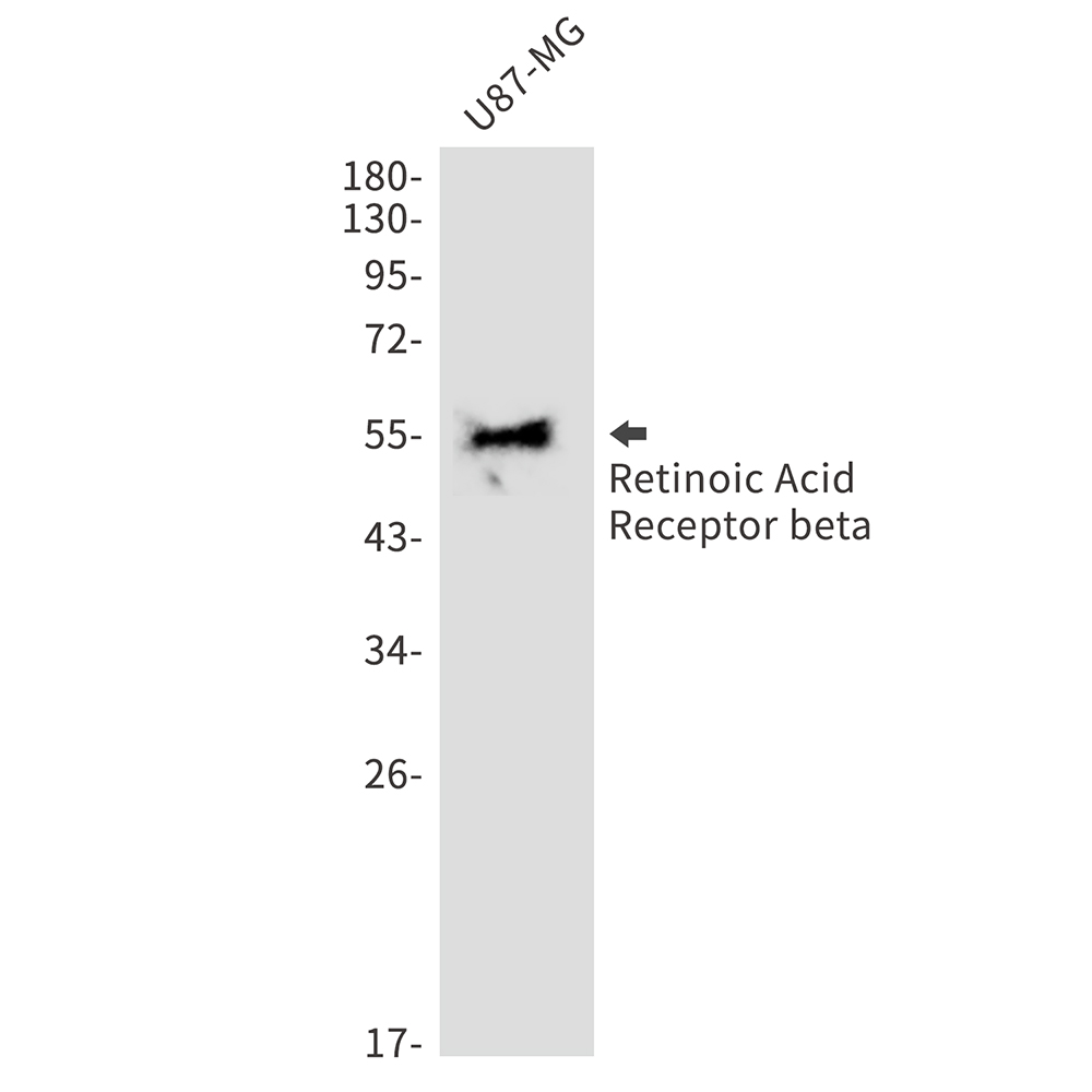 Retinoic Acid Receptor beta Rabbit mAb