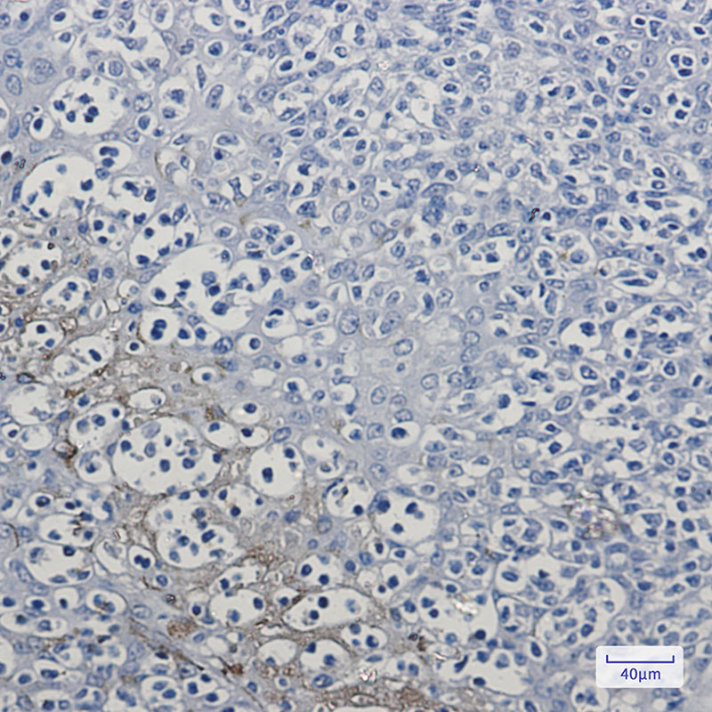 RKIP Rabbit mAb