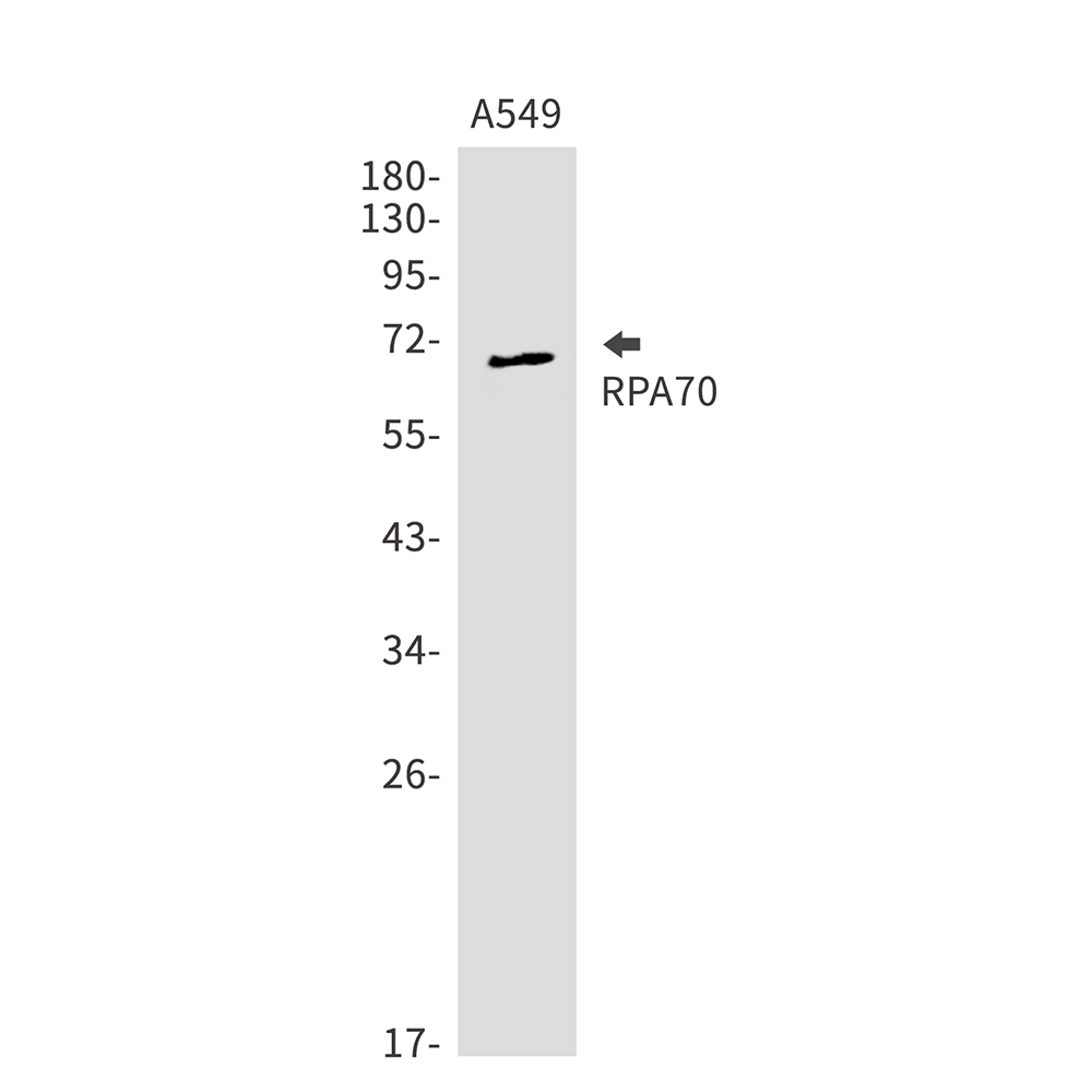 RPA70 Rabbit mAb