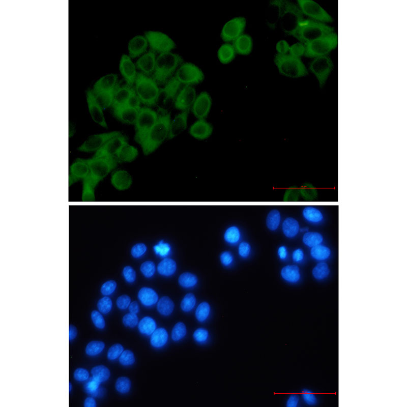 RRM1 Rabbit mAb
