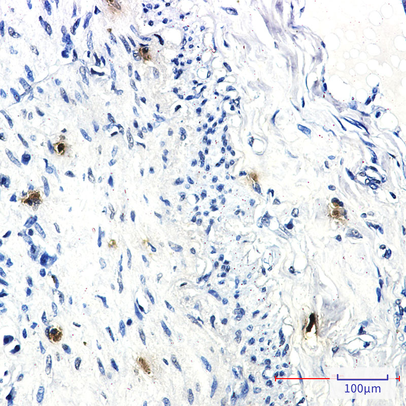 RRM1 Rabbit mAb