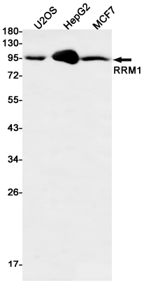 RRM1 Rabbit mAb