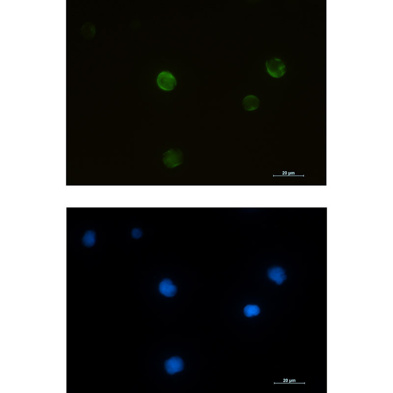 RRM2 Rabbit mAb