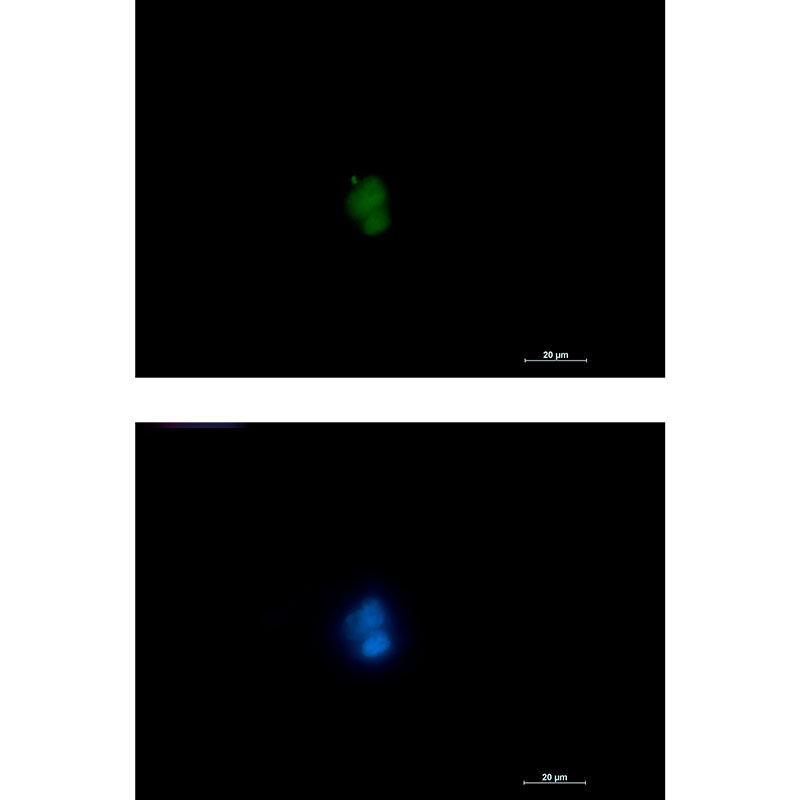 RUNX Rabbit mAb