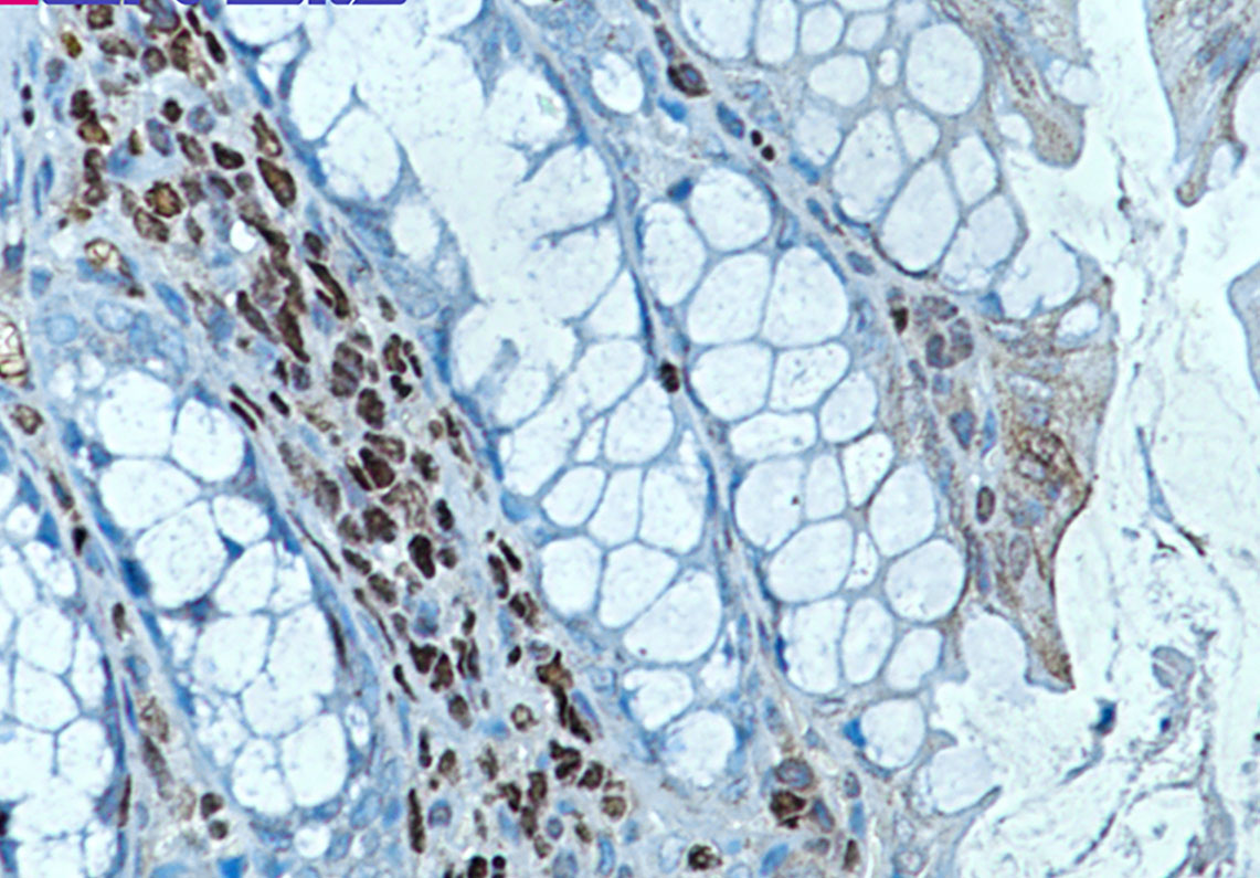 RUNX Rabbit mAb