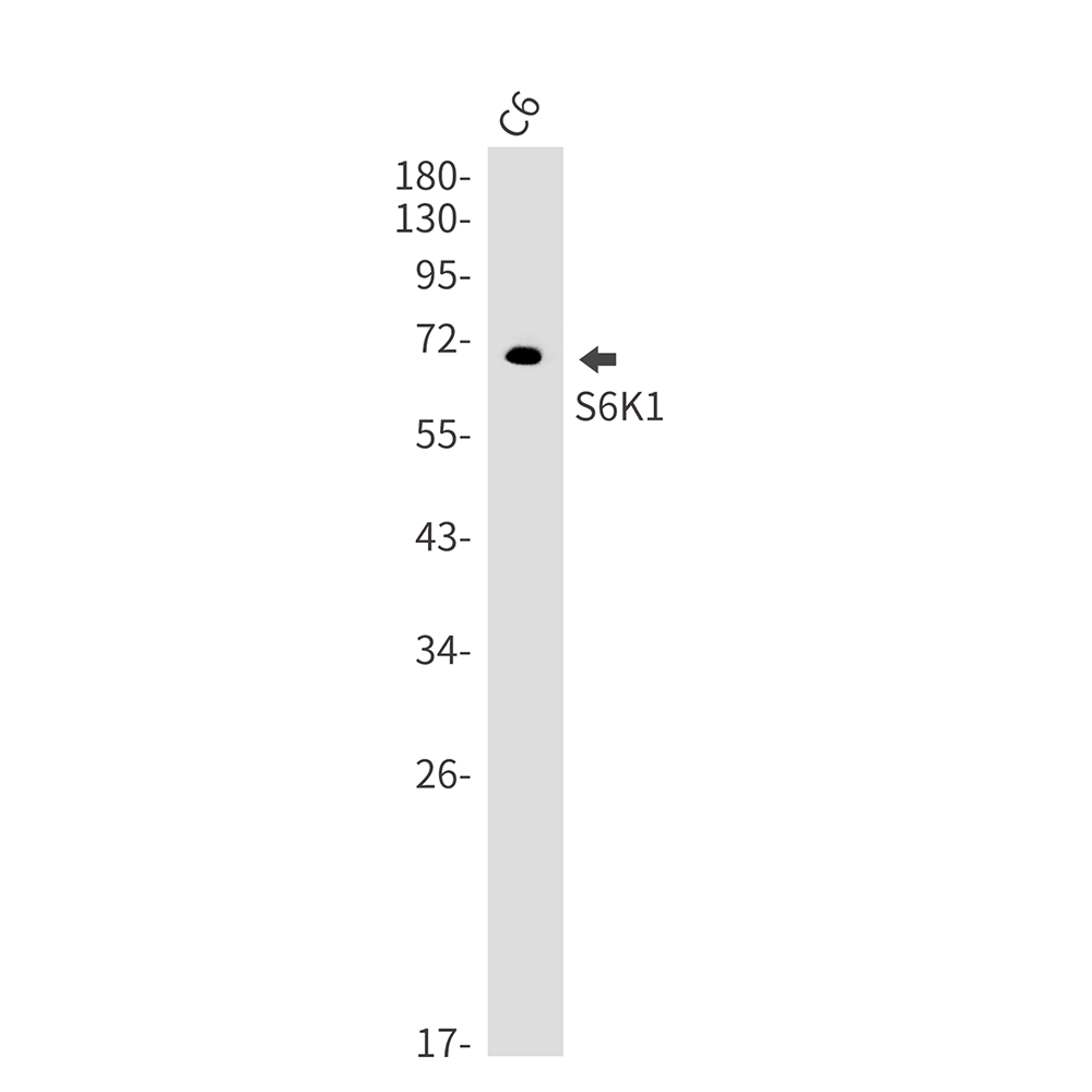 S6K1 Rabbit mAb