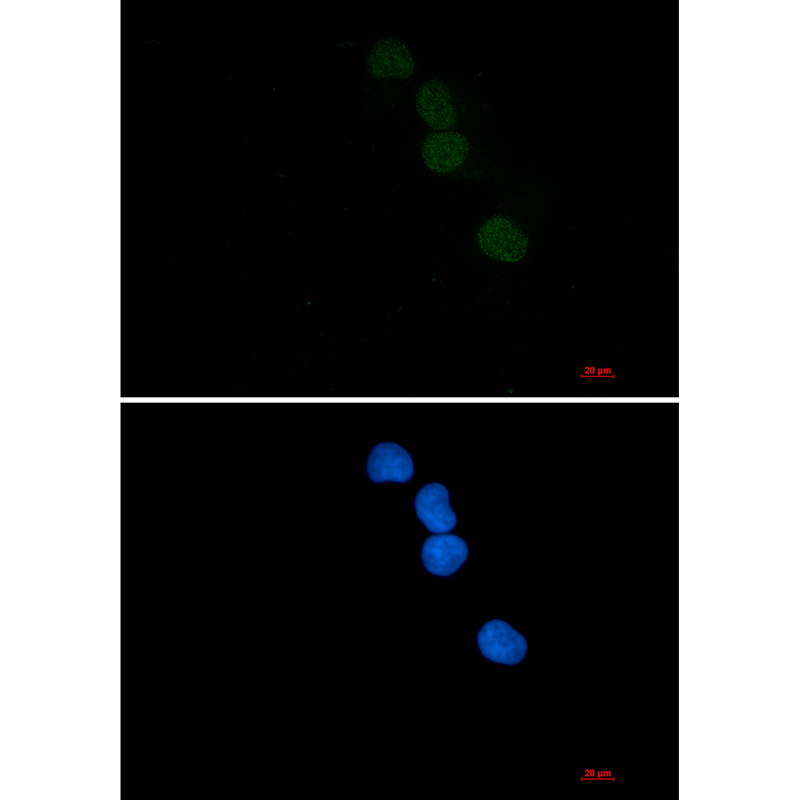 SAE1 Rabbit mAb