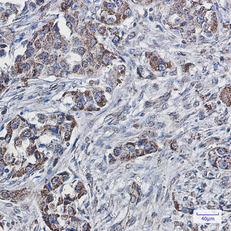 SEC61A Rabbit mAb