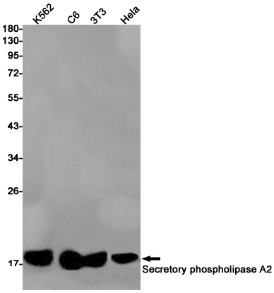 Secretory Phospholipase A2 Rabbit mAb