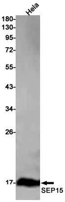 SEP15 Rabbit mAb