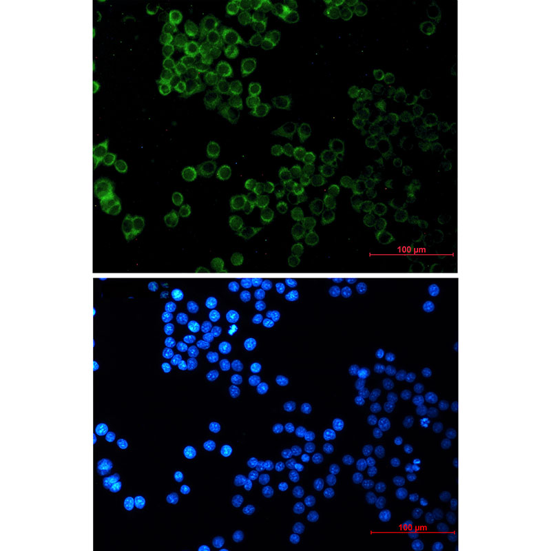 SESN2 Rabbit mAb