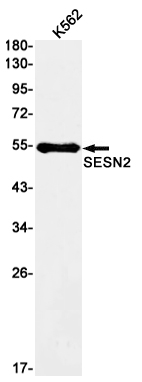 SESN2 Rabbit mAb