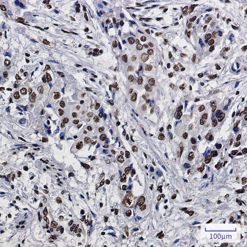 SET Rabbit mAb